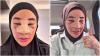 Viral Clara Shinta Oplas Hidung di Thailand, Ini Fotonya!