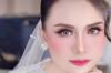 Sebar Hoaks, Model Ansy Jan De Vries Ternyata Alami Bisul Pecah Bukan Dibacok Begal
