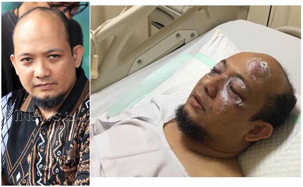 Novel Baswedan Selesai Jalani Operasi Tambahan di Mata Kiri