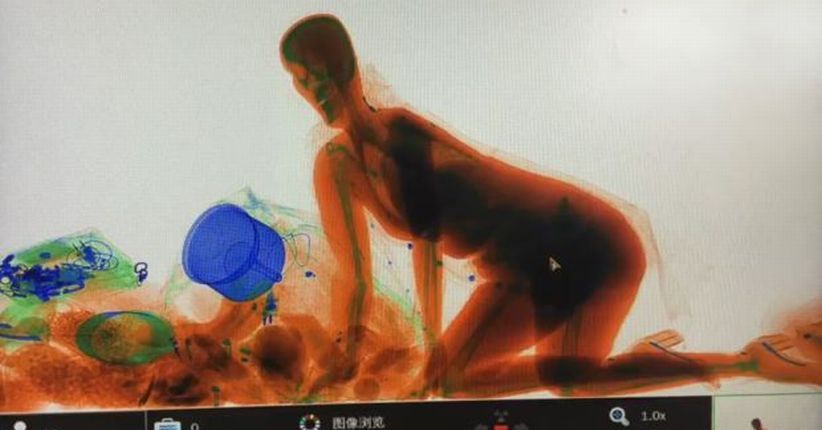 Edan, Wanita Ini Nekat Masuk Mesin X-ray karena Tak Mau Melepas Tasnya