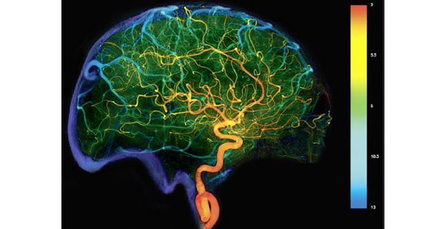 Dipecat IDI, Ini Metode Cuci Otak Dokter Terawan