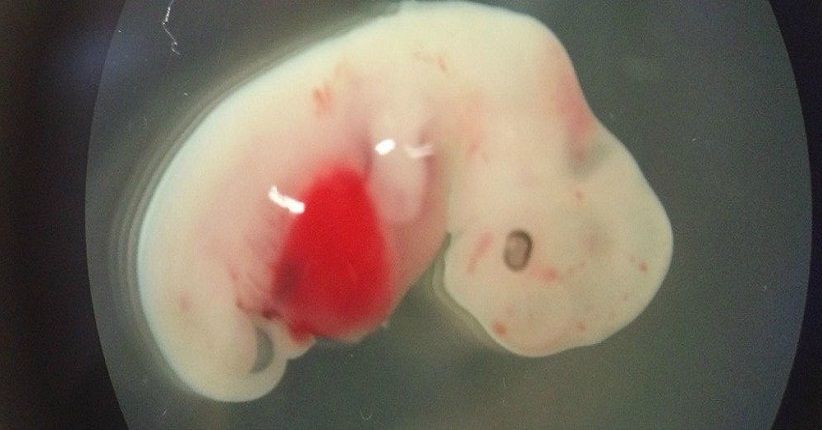 Ilmuwan Ciptakan Hibrida Manusia-Domba, Ini Detailnya