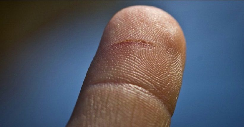 Alasan Ilmiah Potongan Kertas Bisa Bikin Tangan Anda Terluka