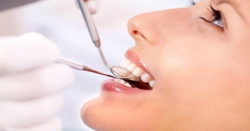 Makanan dan Minuman Ini Bisa Bikin Gigi Kuning