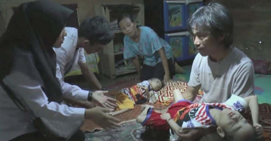 Duh, Masyarakat Aceh Alami Masalah Kekurangan Gizi