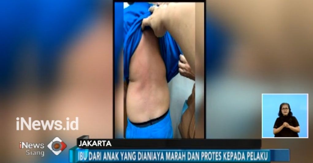 Pria Penendang Bocah di Kelapa Gading Bisa Dijerat Kekerasan pada Anak