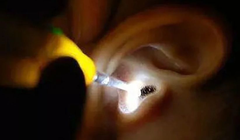 Kecoak Masuk ke Kuping Perempuan Muda Ini, kok Bisa?