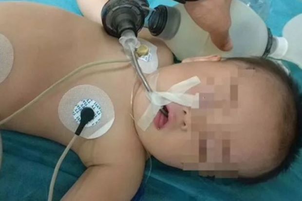 Bayi di China Kritis akibat Nyaris Tenggelam saat Rayakan Ultah ke-1