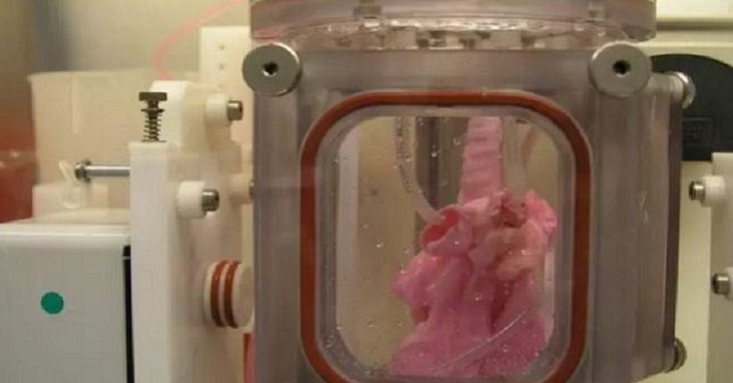 Ilmuwan Sukses Transplantasi Paru-Paru Buatan ke Babi