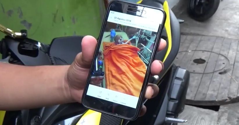 Bocah Perempuan 2,5 Tahun Koma setelah Dihajar Ayah Tiri di Cilincing