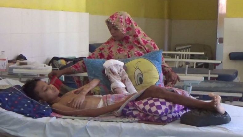 Malangnya, Bocah Penjual Bakpao di Tanjung Balai Tersiram Air Panas