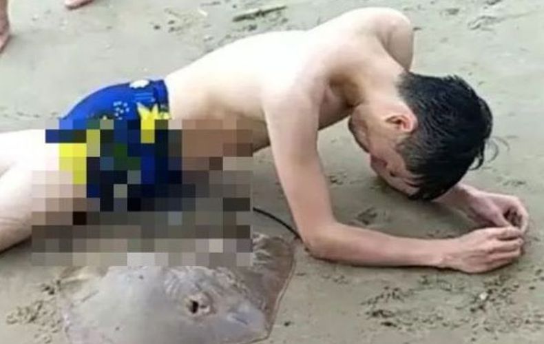 Turis Diserang Ikan Pari, Duri Ekornya Menancap di Alat Kelamin