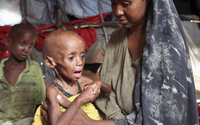 PBB: Tiap 5 Detik, 1 Anak Meninggal Dunia