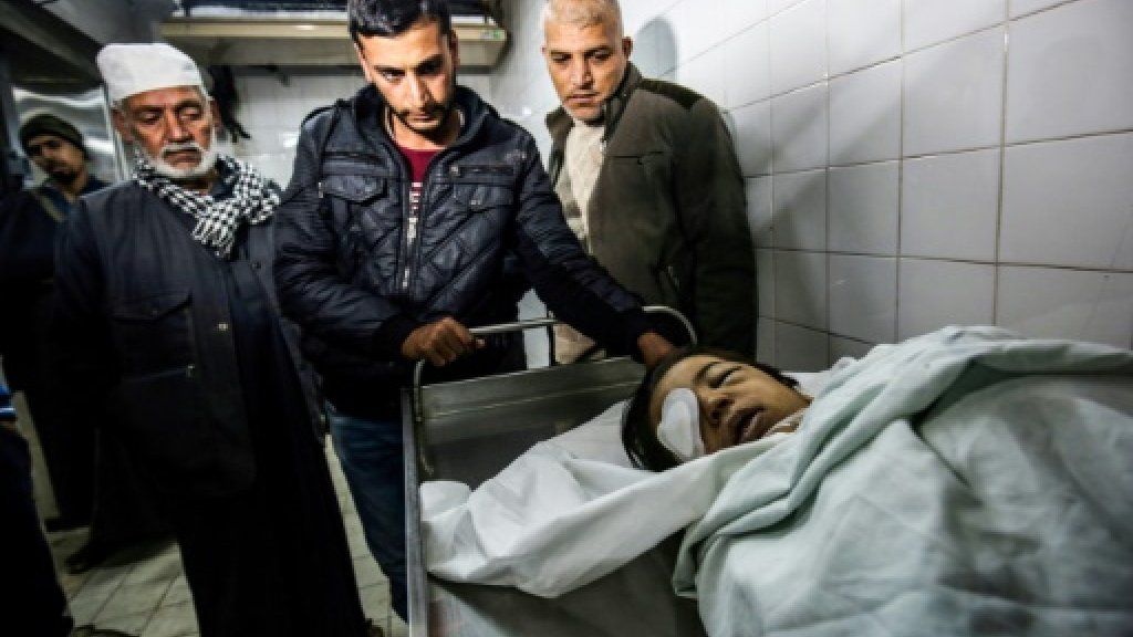 Bocah Palestina Tewas Diduga Kena Pecahan Peluru saat Bentrokan Gaza