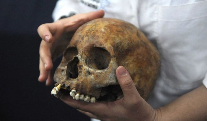 Heboh Tengkorak Asli Manusia Jadi Alat Bantu Pelajaran SMA di Jepang