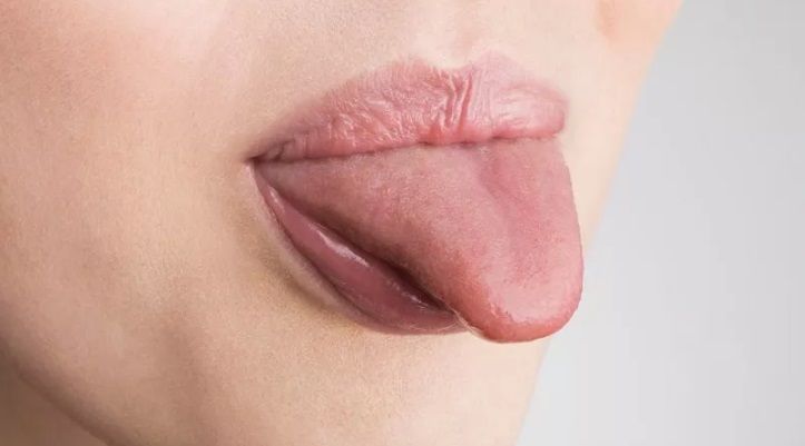 Kanker Pankreas Bisa Dideteksi dari Kondisi Lidah Anda