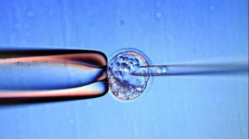 Bawa Embrio Manusia Dalam Koper, Pria Malaysia Ditangkap di India