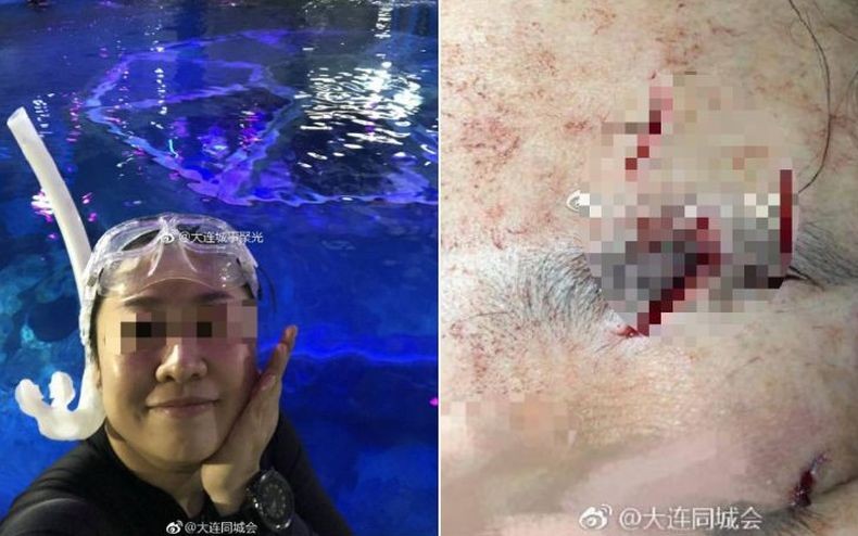 Ikut Pelatihan Menyelam di Akuarium, Perempuan Ini Diterkam Hiu Macan
