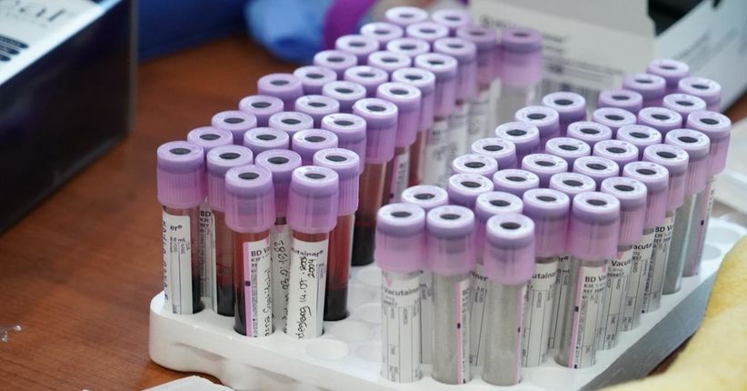 Mengenal Jenis Talasemia dan Cara Cegah dengan Deteksi Dini