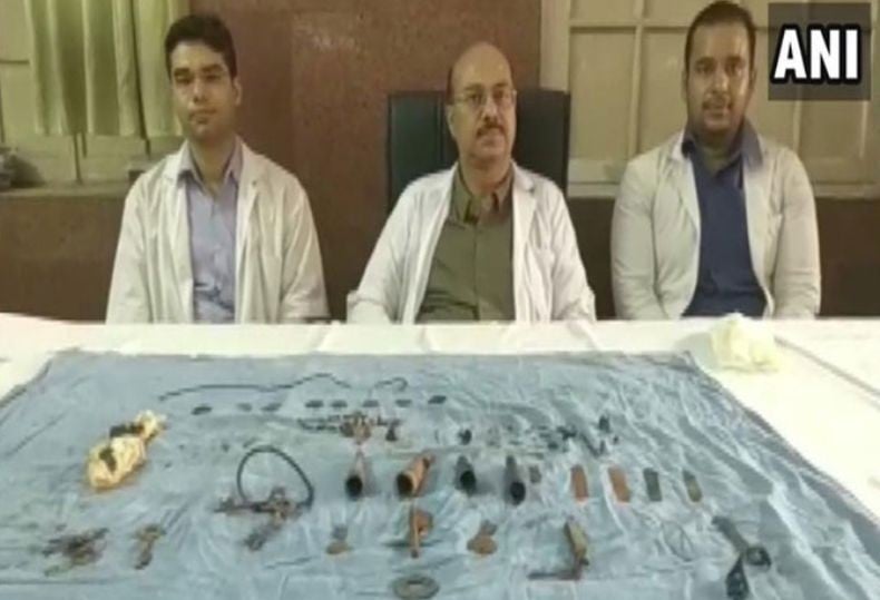 Dokter Keluarkan 80 Benda Asing dari Perut Pria India, dari Paku sampai Kunci