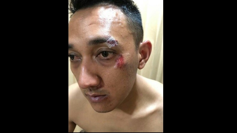 Kapolsek Patumbak Dikeroyok Bandar Narkoba di Deliserdang