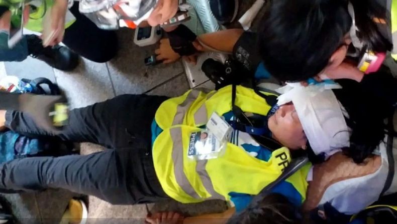 Tertembak saat Meliput Demonstrasi di Hong Kong, Jurnalis WNI Alami Sobek di Mata