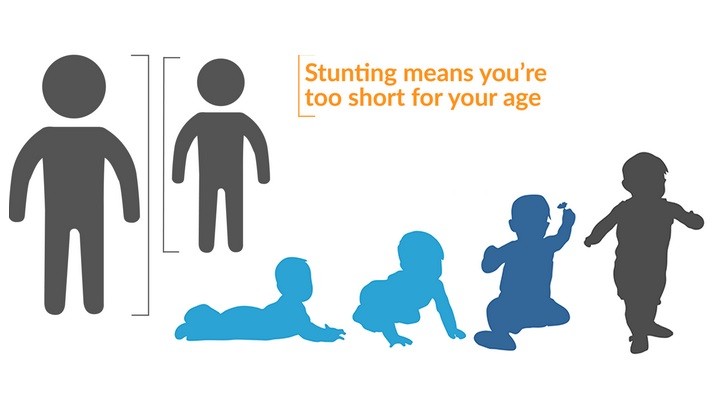 Stunting Sulit Diperbaiki jika Anak Sudah Lewati Usia 2 Tahun, Ini Pencegahannya