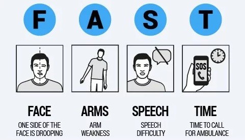 Tanda-Tanda Stroke, Perhatikan 3 Gejala Ini di Tubuh Anda