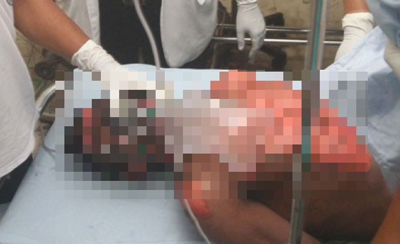 Pipa Air Mendidih Bocor dan Banjiri Kamar Hotel di Rusia, 5 Orang Tewas