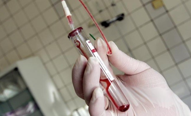 Studi: Pemilik Golongan Darah A Lebih Rentan Kena Virus Korona