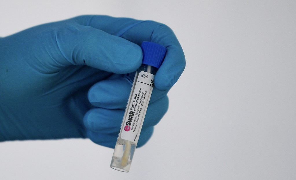 5 Biarawati Indonesia yang Tinggal di Italia Terinfeksi Virus Corona