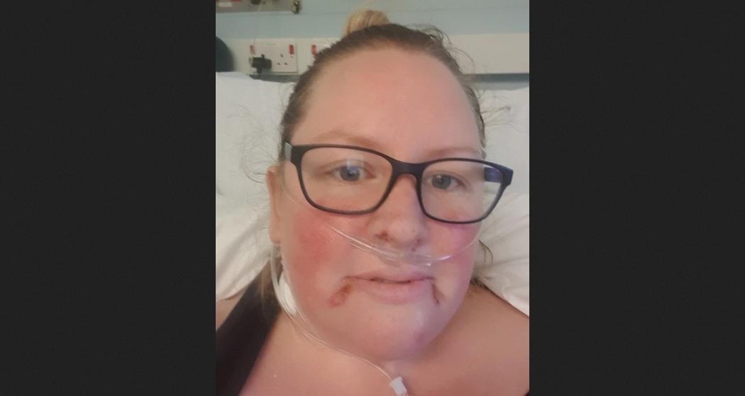 Siuman setelah 6 Hari Koma karena Corona, Perempuan Ini Melihat 'Alien' 