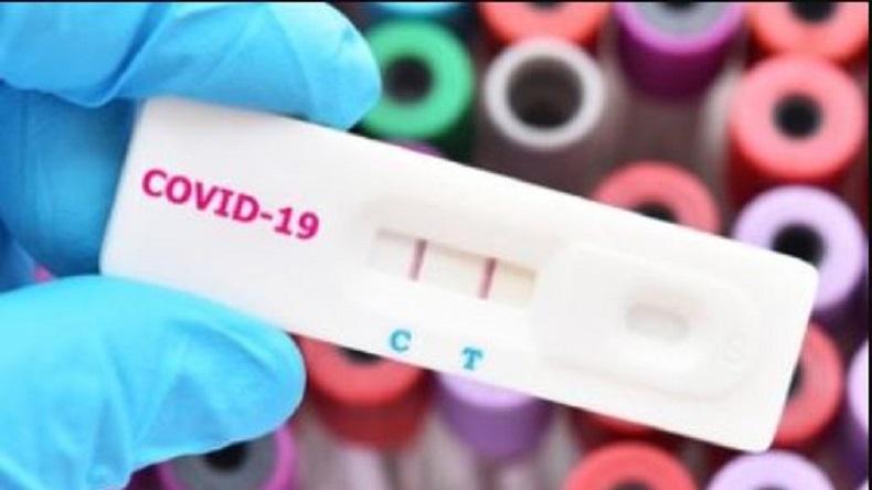 Ini 3 Faktor Pasien Sembuh Covid-19 Bisa Kembali Terinfeksi