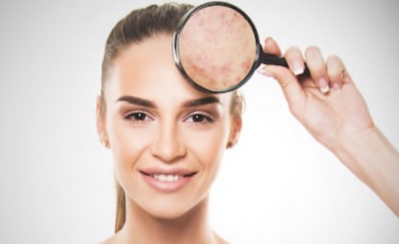 Selain Air Putih, Ini Perawatan agar Kulit Sehat dan Glowing Selama Puasa