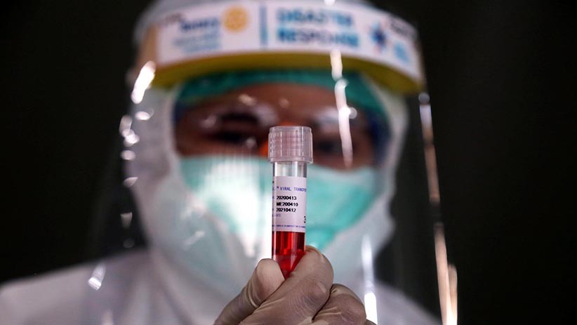 Dinkes KBB Harap-harap Cemas, Hasil Swab Test 120 ASN Kontak Erat Belum Keluar