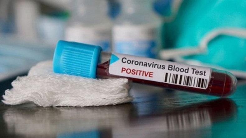 Pesumo Jepang Meninggal Dunia Akibat Corona