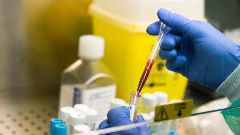 Perusahaan Farmasi Jepang Uji Coba Obat Corona dari Plasma Darah