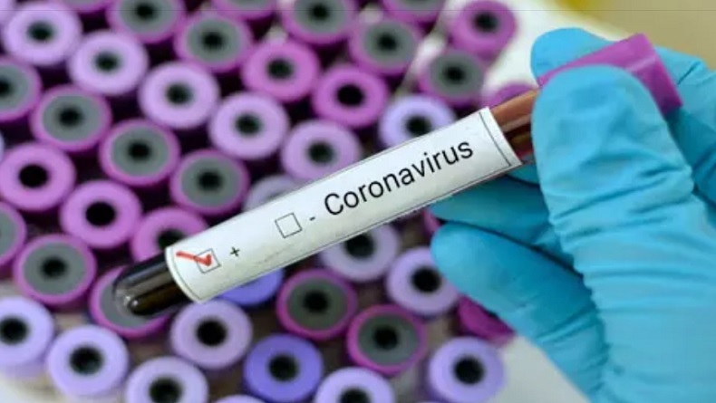 Update Corona di Kalsel 26 Mei: Bertambah 28 Kasus, Total Positif Menjadi 630 Pasien