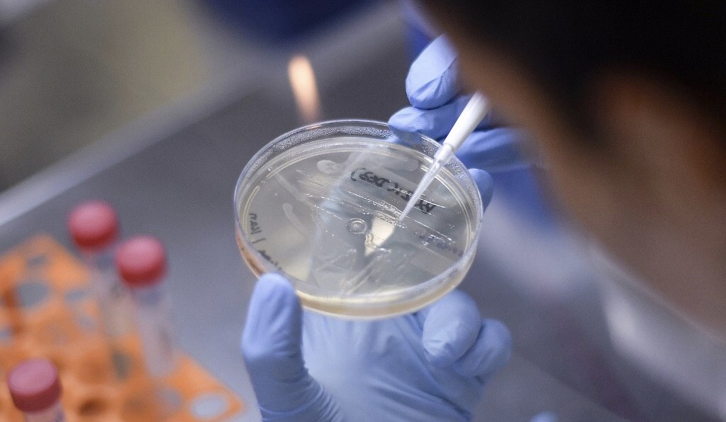 Thailand Uji Coba Vaksin Virus Corona pada Manusia Akhir 2020, Cari Sukarelawan