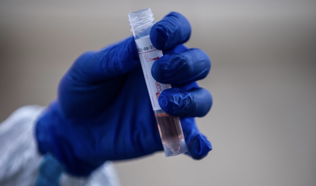 400 Karyawan Rumah Jagal di Jerman Terinfeksi Corona, Sekolah-Sekolah Ditutup