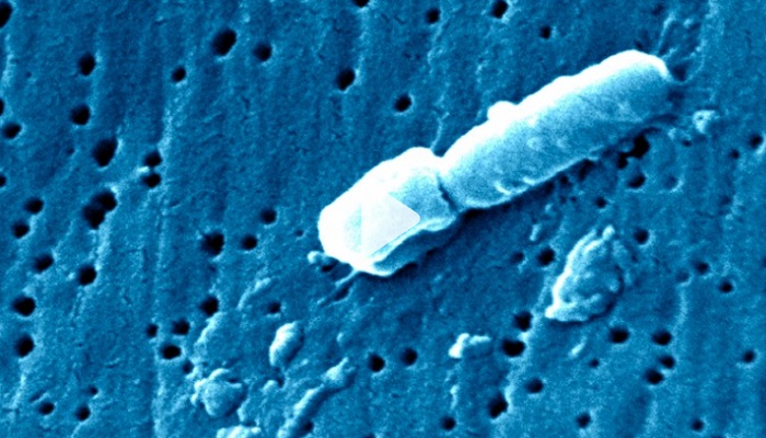 Pejabat China: Muncul Virus Pneumonia Baru Lebih Mematikan dari Covid-19 di Kazakhstan