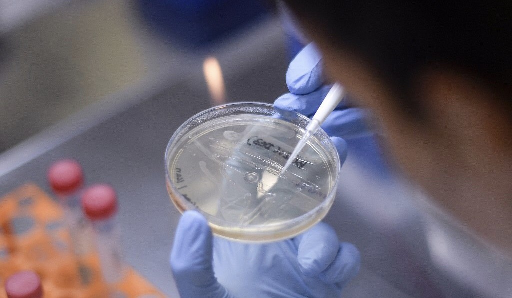 Militer Rusia Klaim Berhasil Uji Coba Vaksin Virus Corona