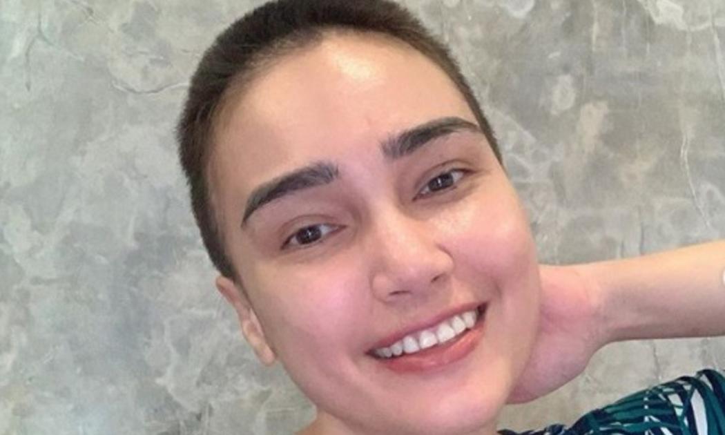 Feby Febiola Potong Rambut saat Jalani Kemoterapi: Cewek Botak Itu Keren
