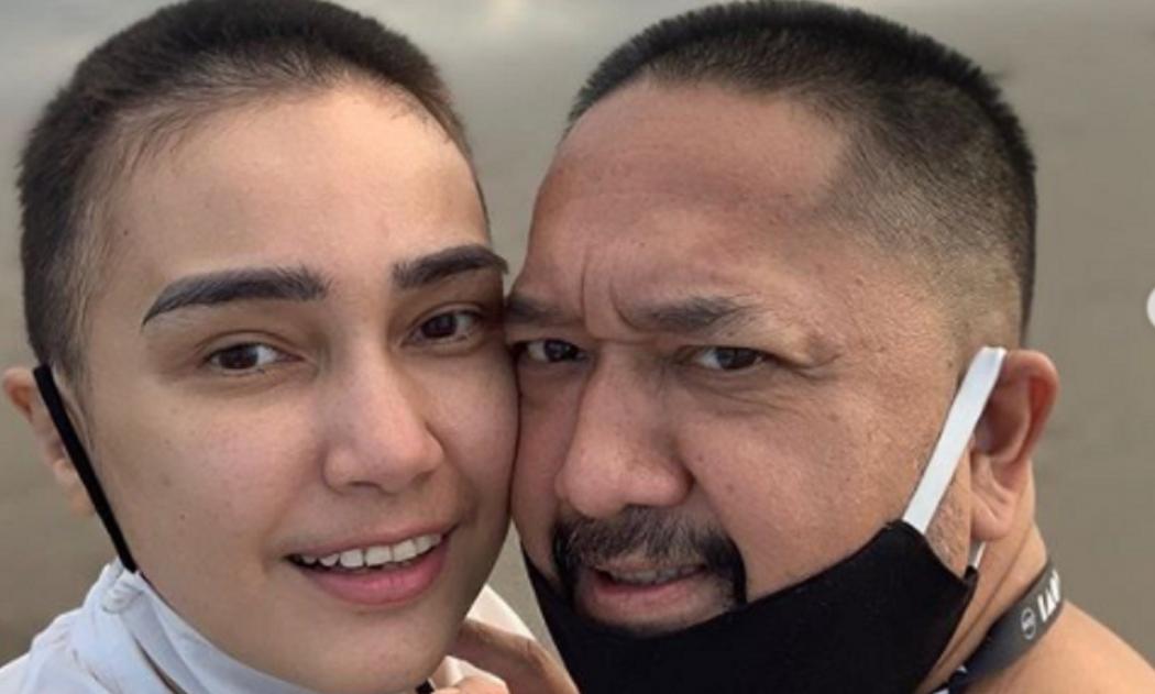 Suami Feby Febiola Rela Botakin Rambut demi Kompak sama Istri