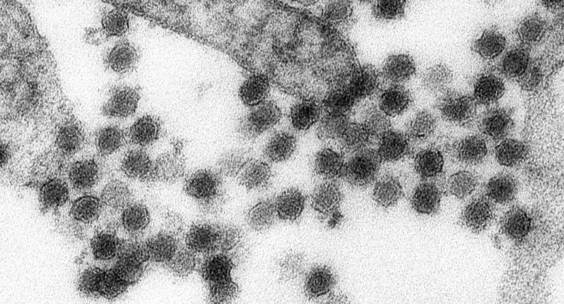 Belum Selesai Covid-19 Spanyol Diserang Virus West Nile, Renggut 2 Nyawa
