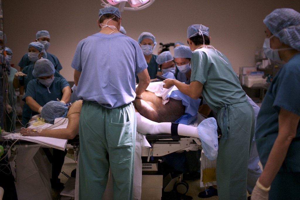 Dokter India Angkat Tumor Ovarium 54 Kg, Terberat di Dunia