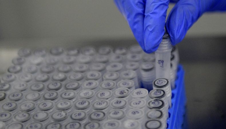 AS Izinkan Pengobatan Pasien Covid-19 Pakai Plasma Darah