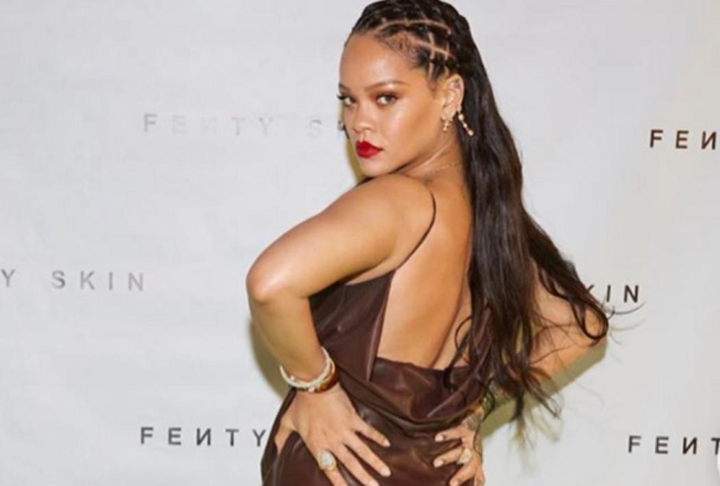 Rihanna Jatuh dari Skuter Listrik, Wajah dan Dahi Memar