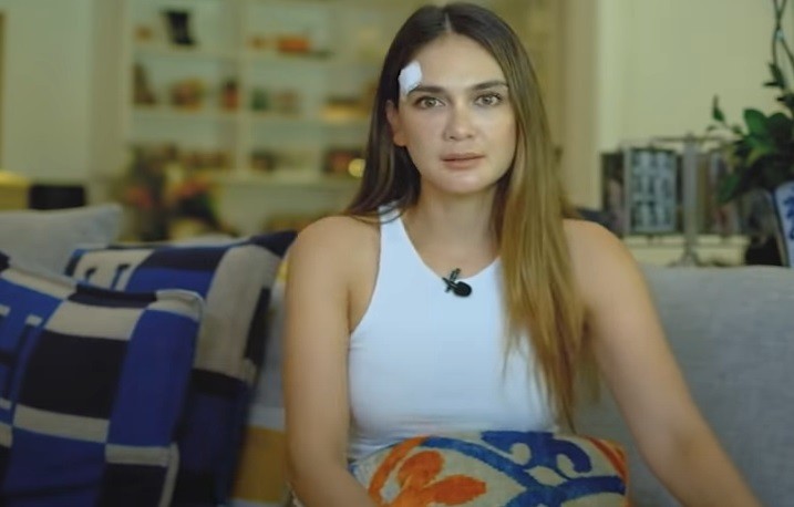 Kisah Luna Maya Jatuh dari Tempat Tidur dan Sepeda, Cedera Kaki hingga Pelipis Robek