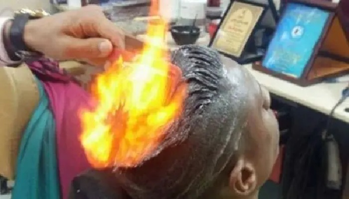 Akibat Ulah Pegawai Salon Amatiran, Rambut Pria Ini Terbakar sampai Dahi